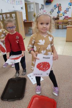 Naše tělo mozek řídí, oči, ty to dobře vidí. Motýlci